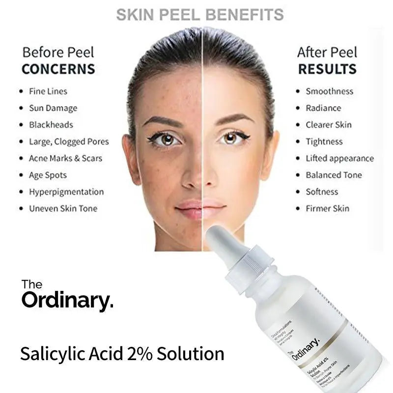 The Ordinary Salicylic Acid 2% Solution